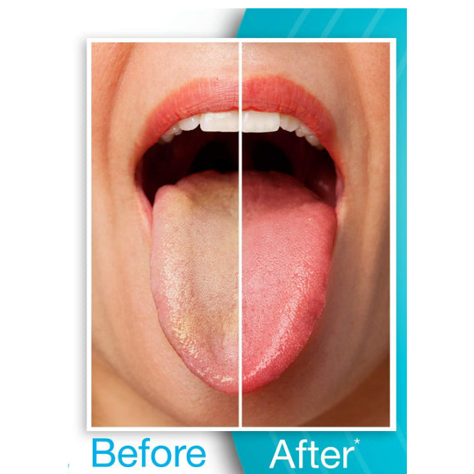USA Onhand | Dr. Tung's, Tongue Cleaner