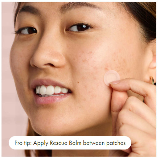 USA Onhand | Hero Cosmetics, Mighty Patch ( Treatments & Serums )