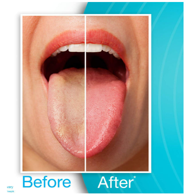 LowCostPh | TheraBreath, Dry Mouth, Mandarin Mint, & Tart Berry, 100 Lozenges| Oral Rinse | Tongue C