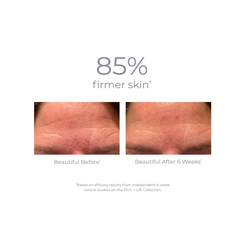 USAOnhand| DERMA E, Stem Cell Eye Lifting Treatment , 1/2 oz (14 g)