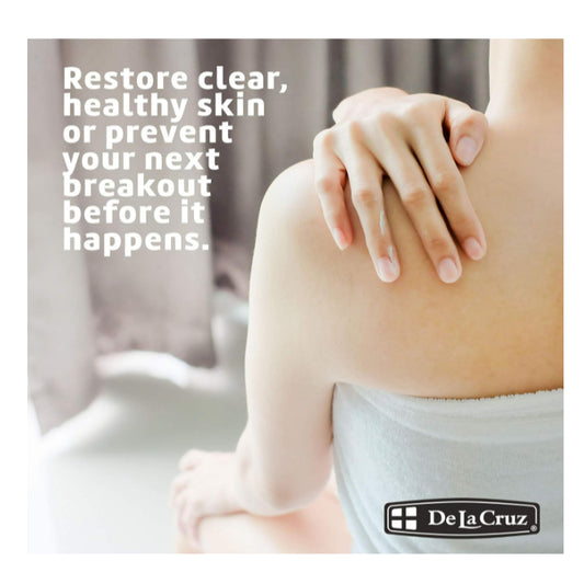 USAOnhand | Acne Treatment Ointment with 10% Sulfur, Maximum Strength, 2.6 oz (73.7 g)