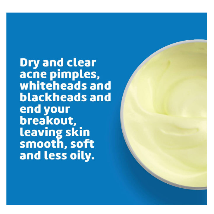 USAOnhand | Acne Treatment Ointment with 10% Sulfur, Maximum Strength, 2.6 oz (73.7 g)
