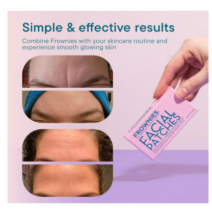 LowCostPH| Frownies, Facial Patches for Corners of Eyes & Mouth, 144 Patches| Rosewater Hydrator 59m