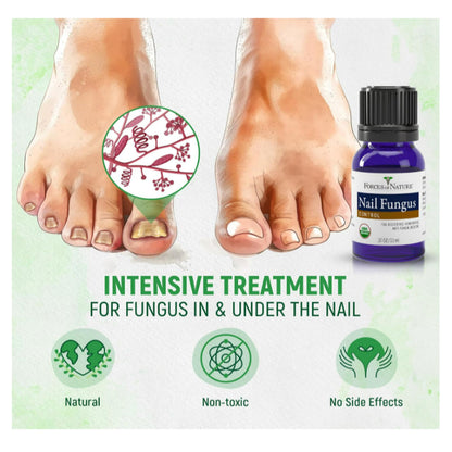 LowCost PH| Forces of Nature, Nail Fungus, Organic Plant Medicine, 0.17 fl oz (5 ml)