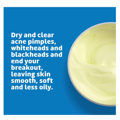 USAOnhand | Acne Treatment Ointment with 10% Sulfur, Maximum Strength, 2.6 oz (73.7 g)